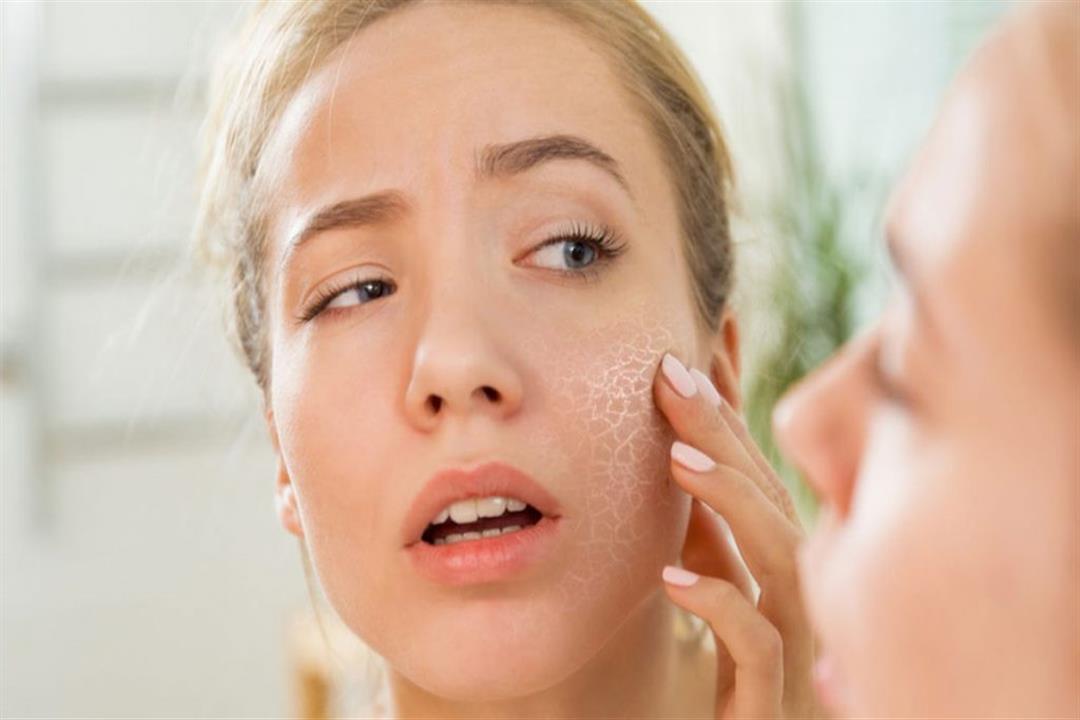 نصائح لعلاج جفاف البشرة 2021 - Dry skin