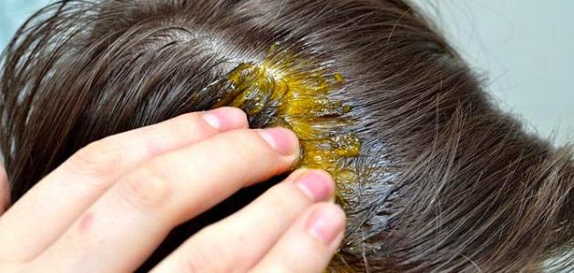 فوائد زيت الثوم لتكثيف الشعر - Garlic oil for hair thickening